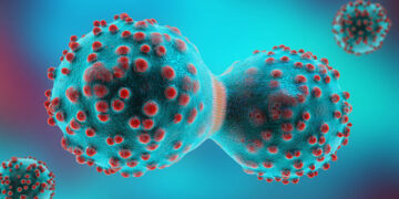 Pakistan: Colon cancer cases are increasing rapidly among young people, Report