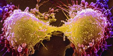 Russian experts have developed a vaccine to prevent cancer