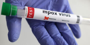 پاکستان میں ایم پاکس کے کیسز کی تعداد 3 ہو گئی، وزارت صحت کی تصدیق