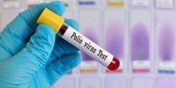 ایک اور بچہ پولیو وائرس کا شکار، متاثرین کی تعداد 43 تک پہنچ گئی