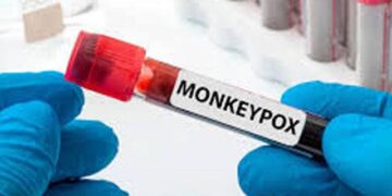 First Mpox Case of the Year Reported at Peshawar Airport