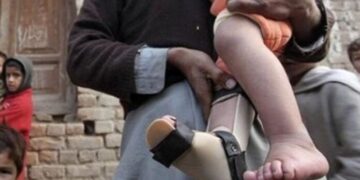Two New Polio Cases Confirmed in Badin and Lower Kohistan, Total Reaches 21 This Year