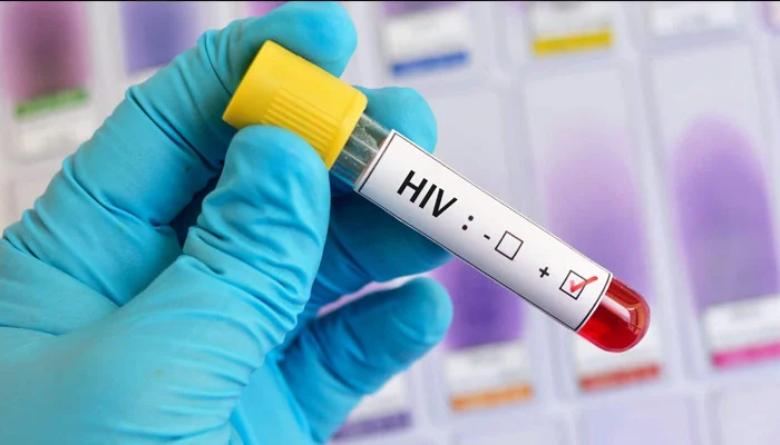 Sindh Orders Crackdown on Quack Doctors as HIV Cases Surge Across Province