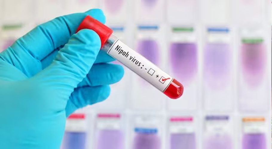 Sindh Health Department Issues Advisory on Spread and Symptoms of Nipah Virus