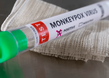 First Monkeypox Case of the Year Reported in Karachi