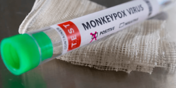 First Monkeypox Case of the Year Reported in Karachi