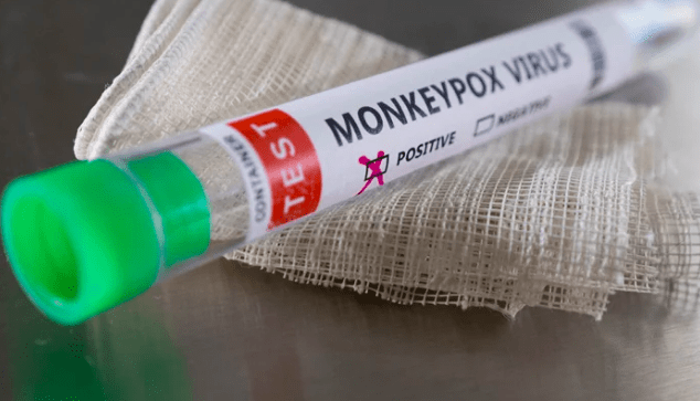 First Monkeypox Case of the Year Reported in Karachi — PakAlerts.net: Sansani Nahi, Srif Khabar — Your go-to digital hub for Breaking News, Analysis, Stories from Pakistan and around the World. Stay informed, Stay connected. First Monkeypox Case of the Year Reported in Karachi