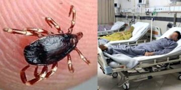 17-Year-Old Dies of Congo Virus in Karachi