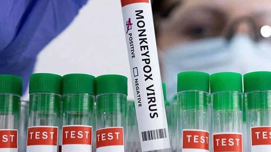 Second Monkeypox Case Reported in Karachi, 22-Year-Old Patient Confirmed — PakAlerts.net: Sansani Nahi, Srif Khabar — Your go-to digital hub for Breaking News, Analysis, Stories from Pakistan and around the World. Stay informed, Stay connected. Second Monkeypox Case Reported in Karachi, 22-Year-Old Patient Confirmed