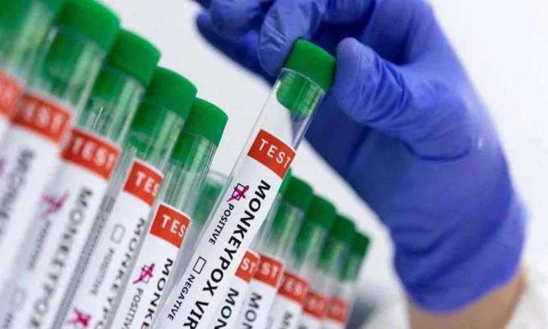 Monkeypox Cases Rise to 9 in Karachi After New Infection Confirmed