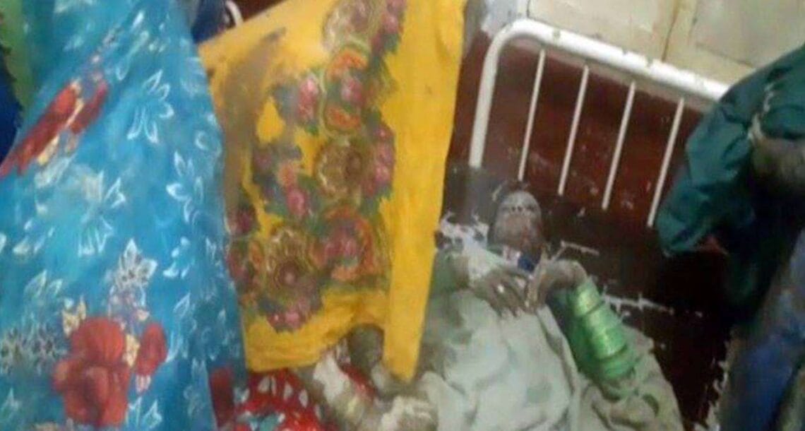 ضلع میرپور خاص میں ایک ٹرک الٹنے کے نتیجے میں خواتین اور بچوں سمیت 80 افراد زخمی