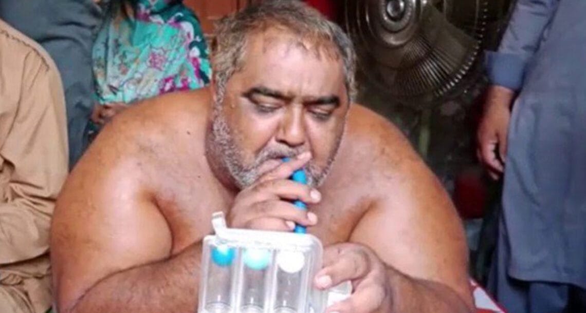 موٹاپے کا شکار 330 کلو وزنی نور حسن لاہور کے اسپتال میں انتقال کرگئے