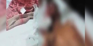 لاڑکانہ میں کتے کے کاٹنے سے زخمی بچہ انتقال کرگیا