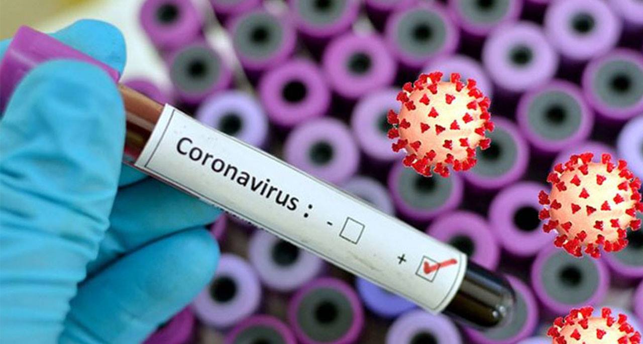 دنیا میں کوروناوائرس سے5 لاکھ57 ہزار405 اموات