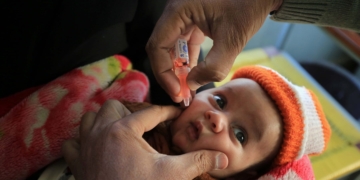 پاکستان میں بچوں میں خسرہ کی وبا دوبارہ پھیلنے کا خطرہ