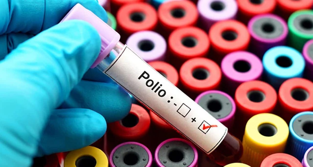 پاکستان کے 7 شہروں میں پولیو وائرس کی تصدیق