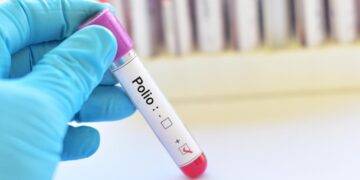 پاکستان کے 8 شہروں میں پولیو وائرس کی تصدیق