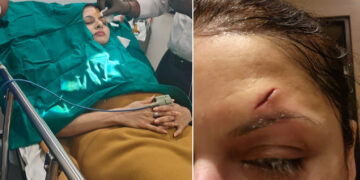 بھاگیاشری حادثے کا شکار، گہرے زخم پر 13 ٹانکے لگے