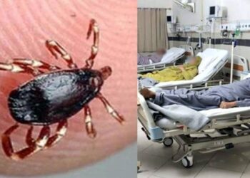 کراچی میں کانگو وائرس سے متاثر 17 سالہ نوجوان جاں بحق