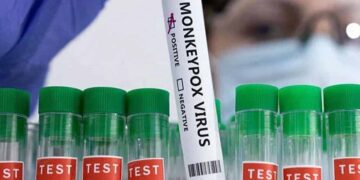 کراچی میں منکی پاکس کا دوسرا کیس رپورٹ، 22 سالہ نوجوان متاثر